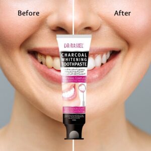 A woman's teeth before and after using Dr.Rashel charcoal whitening cream.