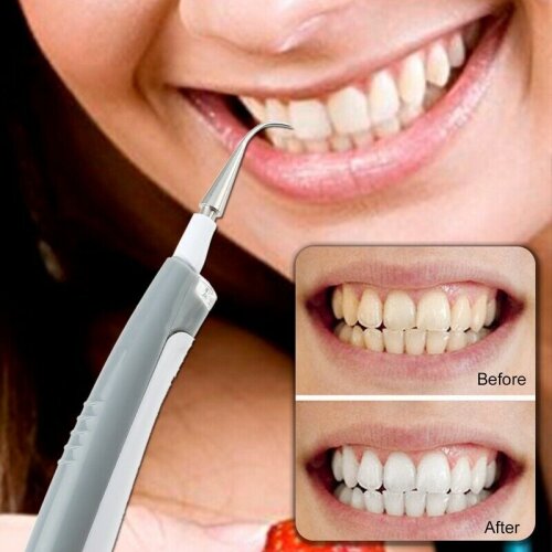 Electric Ultrasonic Dental Scaler Tooth Calculus Remover